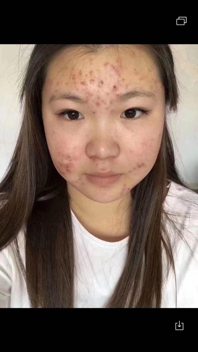 微笑