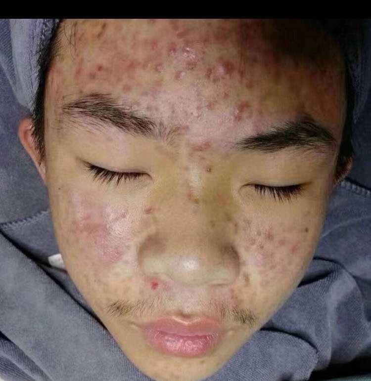 微笑