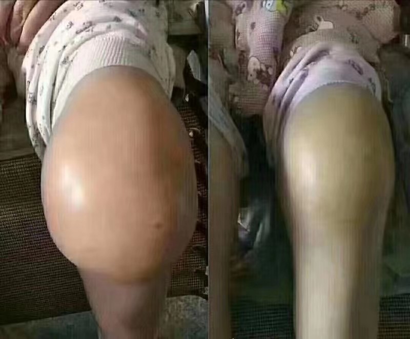 华润中医筋骨养护康复推拿理疗按摩正骨刮痧拔罐艾灸刺络针灸调理风湿骨病